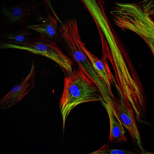 Actin 超分辨探针示意图