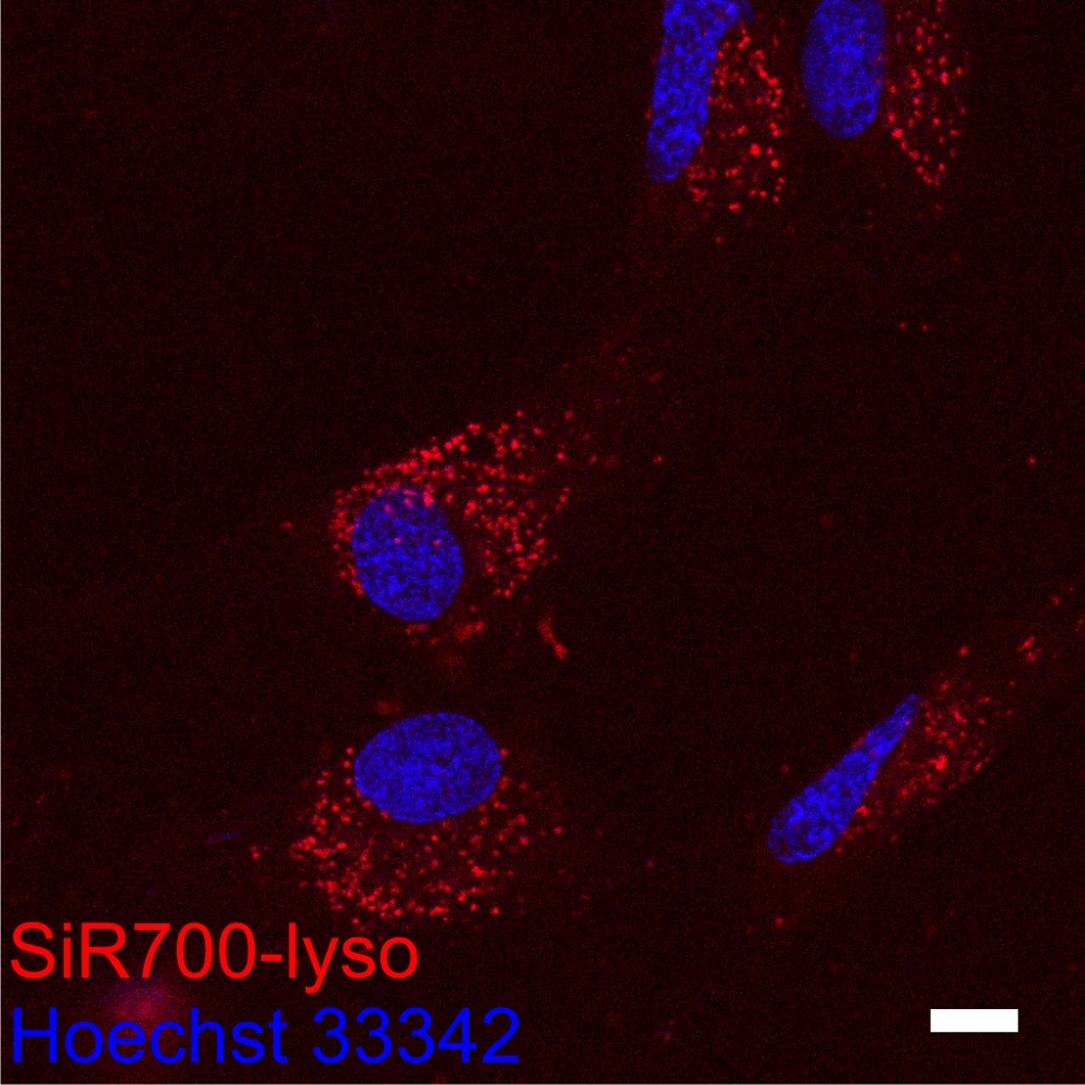 溶酶体超分辨探针示意图