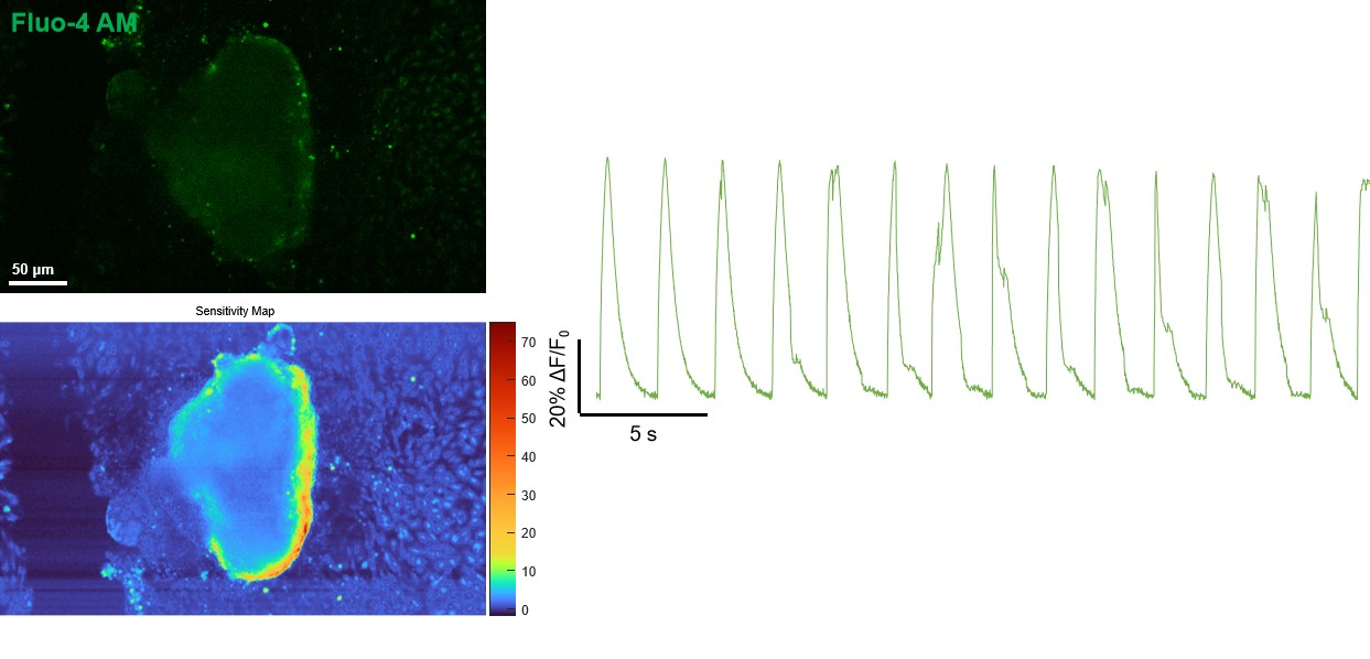心脏类器官钙成像示意图